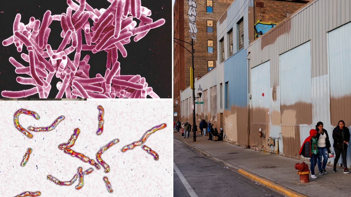 Tuberkulose unter dem Mikroskop und eine Migrantenunterkunft in Chicago