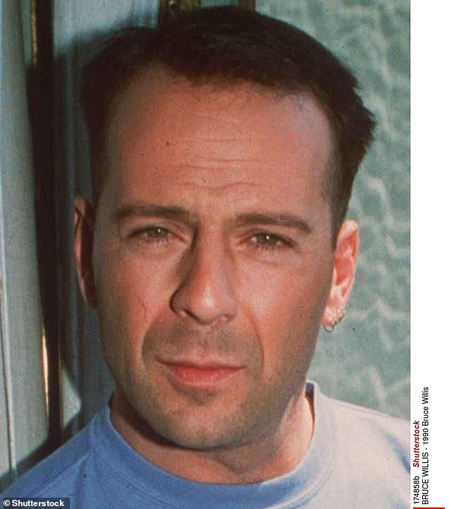 Fans first saw Bruce's hair start to thin when he graced our screens in the TV series Moonlighting where he played detective David Addison