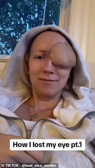 Bei Annika, 28, wurde ein seltener Nasenkrebs diagnostiziert, nachdem Ärzte ihn mit einer Nasennebenhöhlenentzündung verwechselt hatten