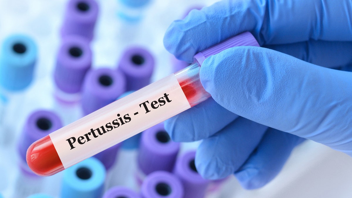 Pertussis-Test