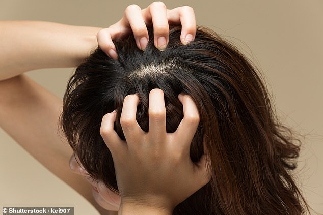 Ein Überschuss an androgenen Hormonen kann auch zu Akne, dünner werdendem Haar, Haarausfall und schlaffem Haar führen, das leicht bricht