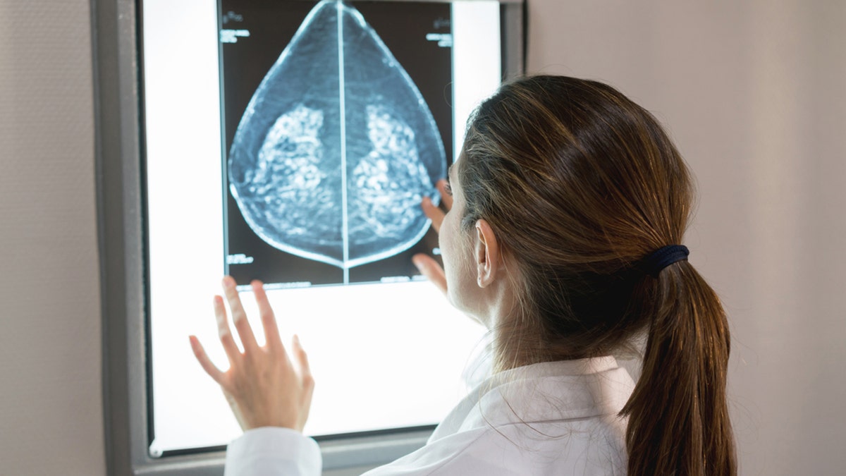 Gynäkologe schaut sich Mammographie an