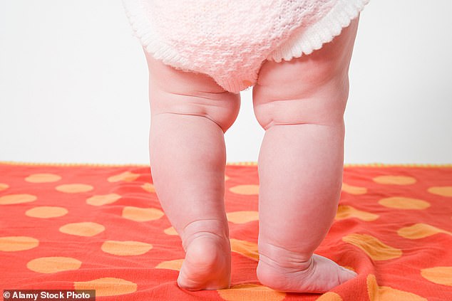 Ein acht Monate altes Baby wurde von einem neuen Dienst für stark fettleibige Kinder untersucht (Archivbild)
