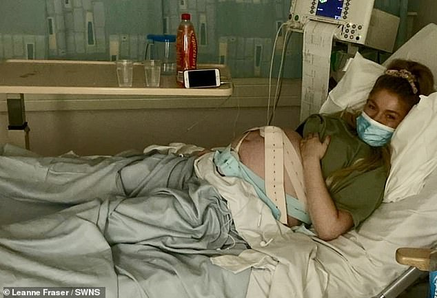 Leanne Fraser, 32, hatte unmittelbar nach der Geburt ihres Sohnes Henry vor zwei Jahren plötzlich „unerträgliche“ Schmerzen.  Abgebildet im Krankenhaus vor Henrys Geburt