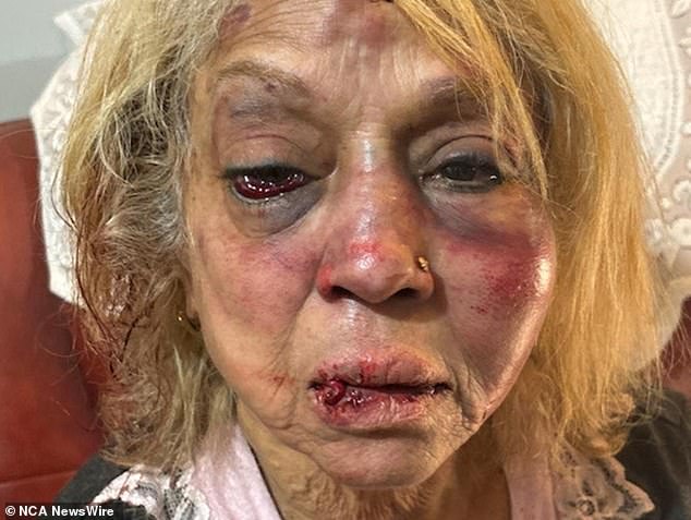 Ninette Simons (im Bild) wurde angeblich angegriffen, wobei die Gruppe sie am Boden festhielt und ihr mehrmals ins Gesicht schlug, wodurch sie bewusstlos wurde