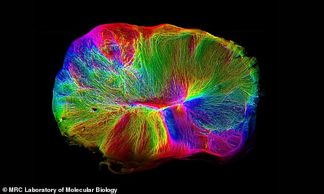 Das winzige Organoid – etwa so groß wie eine Linse – wurde 2019 für eine Studie aus verbundenen menschlichen Gehirnzellen hergestellt.