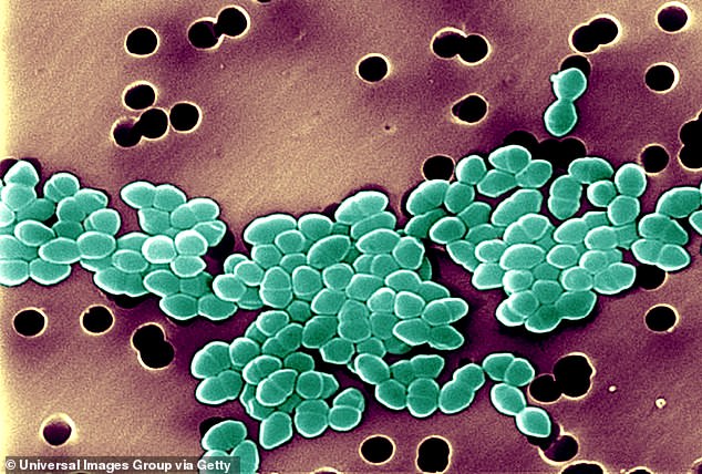Das Gesundheitsamt des Bundesstaates hat das Vorhandensein von Enterokokken-Bakterien im Darmtrakt von Säugetieren festgestellt (im Bild).
