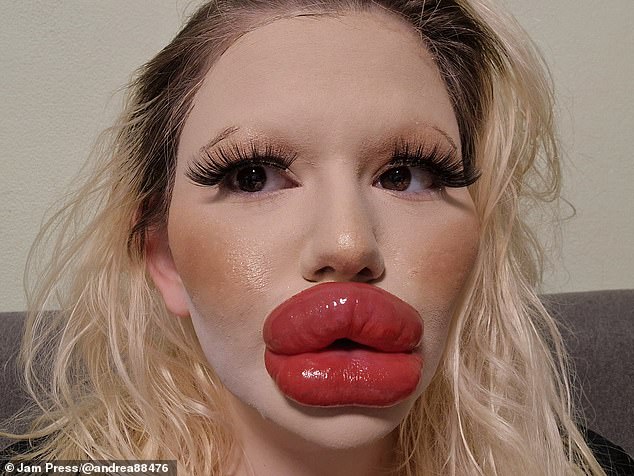 Andrea Ivanova, 26, aus Bulgarien, behauptet, die „größten Lippen der Welt“ zu haben, hat aber zugegeben, dass sie kürzlich Füller auf beiden Seiten ihrer Nase bekommen hat (im Bild: Andrea nach dem Eingriff)